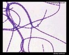 bacillus anthracis micrograph.jpg